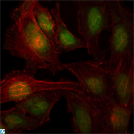 ZBTB7B / HcKrox Antibody - Immunofluorescence (IF) analysis of HeLa cells using TH-POK Monoclonal Antibody (green). Red: Actin filaments have been labeled with Alexa Fluor-555 phalloidin.