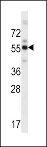 ZBTB8B Antibody - ZBTB8B Antibody western blot of human placenta tissue lysates (35 ug/lane). The ZBTB8B antibody detected the ZBTB8B protein (arrow).