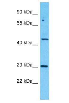 ZBTB8B Antibody - ZBTB8B antibody Western Blot of MCF7. Antibody dilution: 1 ug/ml.  This image was taken for the unconjugated form of this product. Other forms have not been tested.