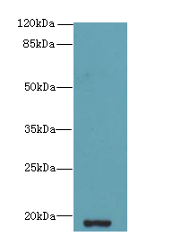 ZBTB8OS Antibody - Western blot. All lanes: ZBTB8OS antibody at 8 ug/ml+HL4- whole cell lysate Goat polyclonal to rabbit at 1:10000 dilution. Predicted band size: 19 kDa. Observed band size: 19 kDa.