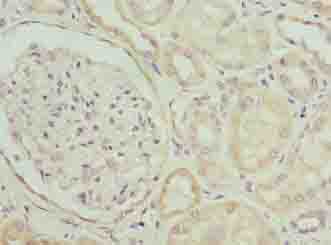 ZBTB8OS Antibody - Immunohistochemistry of paraffin-embedded human kidney tissue using antibody at dilution of 1:100.