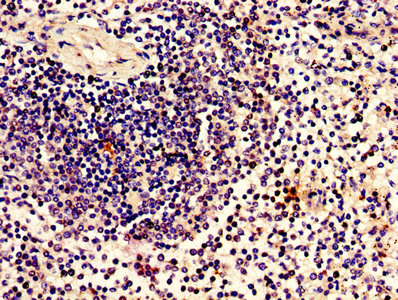 ZBTB8OS Antibody - Immunohistochemistry of paraffin-embedded human kidney tissue using ZBTB8OS Antibody at dilution of 1:100