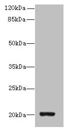 ZBTB8OS Antibody - Western blot All lanes: ZBTB8OS antibody at 8µg/ml + HL60 whole cell lysate Secondary Goat polyclonal to rabbit IgG at 1/10000 dilution Predicted band size: 20, 16 kDa Observed band size: 20 kDa