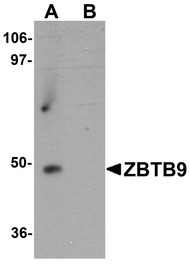 ZBTB9 Antibody - Western blot analysis of ZBTB9 in mouse heart tissue lysate with ZBTB9 antibody at 1 ug/ml in (A) the absence and (B) the presence of blocking peptide.
