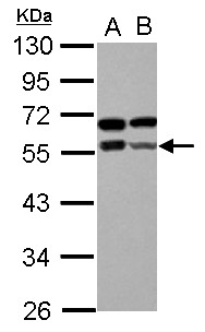 ZBTB9 Antibody - Sample (30 ug of whole cell lysate) A: IMR32 B: U87-MG 10% SDS PAGE ZBTB9 antibody diluted at 1:1000