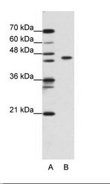ZBTB9 Antibody - A: Marker, B: Jurkat Cell Lysate.  This image was taken for the unconjugated form of this product. Other forms have not been tested.