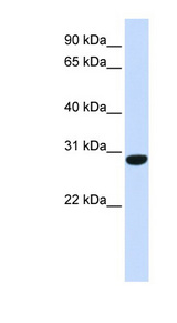 ZC2HC1B / FAM164B Antibody - C6orf94 antibody Western blot of Fetal Muscle lysate. This image was taken for the unconjugated form of this product. Other forms have not been tested.