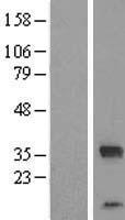 ZC2HC1C Protein - Western validation with an anti-DDK antibody * L: Control HEK293 lysate R: Over-expression lysate