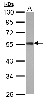 ZC3H10 Antibody - Sample (30 ug of whole cell lysate) A: 293T 10% SDS PAGE ZC3H10 antibody diluted at 1:1000