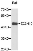 ZC3H10 Antibody - Western blot analysis of extracts of Raji cells, using ZC3H10 antibody at 1:3000 dilution. The secondary antibody used was an HRP Goat Anti-Rabbit IgG (H+L) at 1:10000 dilution. Lysates were loaded 25ug per lane and 3% nonfat dry milk in TBST was used for blocking. An ECL Kit was used for detection and the exposure time was 90s.