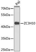 ZC3H10 Antibody - Western blot analysis of extracts of Raji cells using ZC3H10 Polyclonal Antibody at dilution of 1:3000.