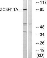 ZC3H11A Antibody - Western blot analysis of lysates from COS cells, using ZC3H11A Antibody. The lane on the right is blocked with the synthesized peptide.