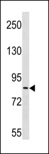 ZC3H11A Antibody - ZC3H11A Antibody western blot of Ramos cell line lysates (35 ug/lane). The ZC3H11A antibody detected the ZC3H11A protein (arrow).