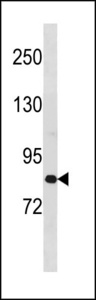 ZC3H11A Antibody - ZC3H11A Antibody western blot of mouse spleen tissue lysates (35 ug/lane). The ZC3H11A antibody detected the ZC3H11A protein (arrow).