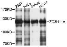 ZC3H11A Antibody - Western blot analysis of extracts of various cell lines, using ZC3H11A antibody at 1:1000 dilution. The secondary antibody used was an HRP Goat Anti-Rabbit IgG (H+L) at 1:10000 dilution. Lysates were loaded 25ug per lane and 3% nonfat dry milk in TBST was used for blocking. An ECL Kit was used for detection and the exposure time was 10s.