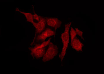 ZC3H11A Antibody - Staining MCF-7 cells by IF/ICC. The samples were fixed with PFA and permeabilized in 0.1% Triton X-100, then blocked in 10% serum for 45 min at 25°C. The primary antibody was diluted at 1:200 and incubated with the sample for 1 hour at 37°C. An Alexa Fluor 594 conjugated goat anti-rabbit IgG (H+L) Ab, diluted at 1/600, was used as the secondary antibody.