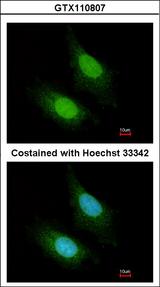 ZC3H12A / MCPIP1 Antibody - Immunofluorescence of paraformaldehyde-fixed HeLa using ZC3H12A antibody at 1:200 dilution.