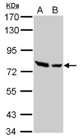 ZC3H12A / MCPIP1 Antibody - ZC3H12A antibody [N3C3] detects ZC3H12A protein by Western blot analysis. A. 30 ug 293T whole cell lysate/extract. B. 30 ug A431 whole cell lysate/extract. 7.5 % SDS-PAGE. ZC3H12A antibody [N3C3] dilution:1:1000