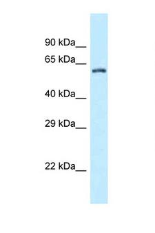 ZC3H12A / MCPIP1 Antibody - ZC3H12A / MCPIP antibody Western blot of Fetal Brain lysate. Antibody concentration 1 ug/ml.  This image was taken for the unconjugated form of this product. Other forms have not been tested.
