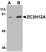 ZC3H12A / MCPIP1 Antibody - Western blot analysis of ZC3H12A in Raji cell lysate with ZC3H12A antibody at (A) 1 and (B) 2 ug/ml.