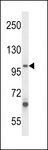 ZC3H12B Antibody - ZC3H12B Antibody western blot of A549 cell line lysates (35 ug/lane). The ZC3H12B antibody detected the ZC3H12B protein (arrow).