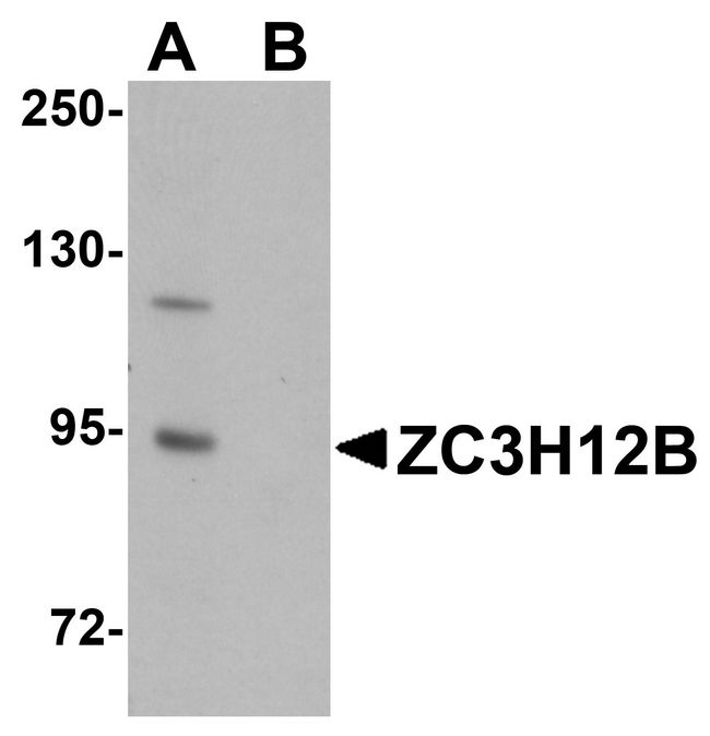 ZC3H12B Antibody - Western blot analysis of ZC3H12B in mouse brain tissue lysate with ZC3H12B antibody at 1 ug/ml in (A) the absence and (B) the presence of blocking peptide.