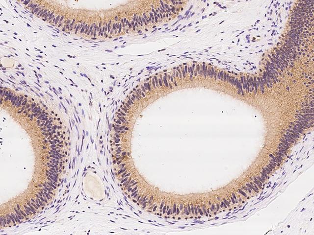 ZC3H12C Antibody - Immunochemical staining of human ZC3H12C in human epididymis with rabbit polyclonal antibody at 1:100 dilution, formalin-fixed paraffin embedded sections.