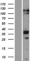 ZC3H12C Protein - Western validation with an anti-DDK antibody * L: Control HEK293 lysate R: Over-expression lysate