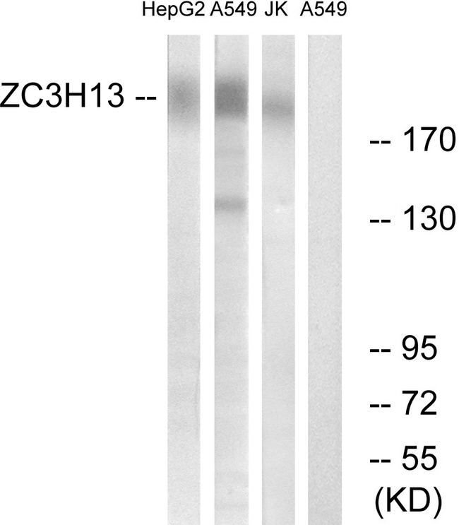 ZC3H13 Antibody - Western blot analysis of lysates from A549, Jurkat, HepG2 cells, using ZC3H13 Antibody. The lane on the right is blocked with the synthesized peptide.