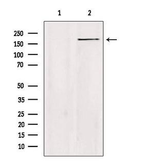 ZC3H13 Antibody - Western blot analysis of extracts of HeLa cells using ZC3H13 antibody. Lane 1 was treated with the blocking peptide.