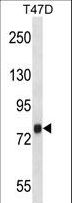 ZC3H14 Antibody - ZC3H14 Antibody western blot of T47D cell line lysates (35 ug/lane). The ZC3H14 antibody detected the ZC3H14 protein (arrow).