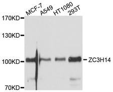 ZC3H14 Antibody - Western blot analysis of extracts of various cell lines, using ZC3H14 antibody at 1:1000 dilution. The secondary antibody used was an HRP Goat Anti-Rabbit IgG (H+L) at 1:10000 dilution. Lysates were loaded 25ug per lane and 3% nonfat dry milk in TBST was used for blocking. An ECL Kit was used for detection and the exposure time was 1s.