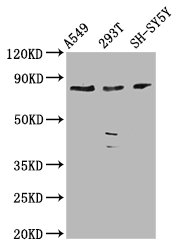 ZC3H14 Antibody - Western Blot Positive WB detected in: A549 whole cell lysate, 293T whole cell lysate, SH-SY5Y whole cell lysate All Lanes: ZC3H14 antibody at 3.9µg/ml Secondary Goat polyclonal to rabbit IgG at 1/50000 dilution Predicted band size: 83, 66, 65, 81, 35, 33, 62, 67 KDa Observed band size: 83 KDa