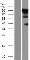 ZC3H14 Protein - Western validation with an anti-DDK antibody * L: Control HEK293 lysate R: Over-expression lysate