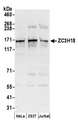 ZC3H18 Antibody - Detection of human ZC3H18 by western blot. Samples: Whole cell lysate (50 µg) from HeLa, HEK293T, and Jurkat cells prepared using NETN lysis buffer. Antibodies: Affinity purified rabbit anti-ZC3H18 antibody used for WB at 0.1 µg/ml. Detection: Chemiluminescence with an exposure time of 30 seconds.