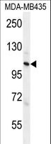 ZC3H3 Antibody - ZC3H3 Antibody western blot of MDA-MB435 cell line lysates (35 ug/lane). The ZC3H3 antibody detected the ZC3H3 protein (arrow).