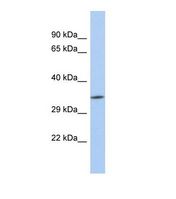 ZC3H3 Antibody - Western blot of Human MCF7. ZC3H3 antibody dilution 1.0 ug/ml.  This image was taken for the unconjugated form of this product. Other forms have not been tested.