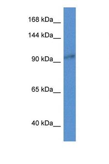 ZC3H3 Antibody - ZC3H3 antibody Western blot of Mouse Pancreas lysate. Antibody concentration 1 ug/ml. This image was taken for the unconjugated form of this product. Other forms have not been tested.