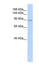 ZC3H7A Antibody - ZC3H7A antibody Western blot of HeLa lysate. This image was taken for the unconjugated form of this product. Other forms have not been tested.