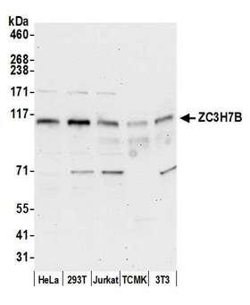 ZC3H7B Antibody - Detection of human and mouse ZC3H7B by western blot. Samples: Whole cell lysate (15 µg) from HeLa, HEK293T, Jurkat, mouse TCMK-1, and mouse NIH 3T3 cells prepared using NETN lysis buffer. Antibody: Affinity purified rabbit anti-ZC3H7B antibody used for WB at 0.04 µg/ml. Detection: Chemiluminescence with an exposure time of 30 seconds.