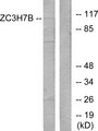 ZC3H7B Antibody - Western blot analysis of lysates from 293 cells, using ZC3H7B Antibody. The lane on the right is blocked with the synthesized peptide.