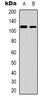 ZC3H7B Antibody - Western blot analysis of ZC3H7B expression in human liver (A); HEK293T (B) whole cell lysates.