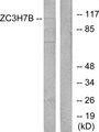 ZC3H7B Antibody - Western blot analysis of extracts from 293 cells, using ZC3H7B antibody.