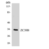 ZC3H8 Antibody - Western blot analysis of the lysates from COLO205 cells using ZC3H8 antibody.