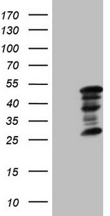 ZC3H8 Antibody - HEK293T cells were transfected with the pCMV6-ENTRY control. (Left lane) or pCMV6-ENTRY ZC3H8. (Right lane) cDNA for 48 hrs and lysed. Equivalent amounts of cell lysates. (5 ug per lane) were separated by SDS-PAGE and immunoblotted with anti-ZC3H8. (1:2000)