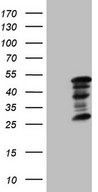 ZC3H8 Antibody - HEK293T cells were transfected with the pCMV6-ENTRY control (Left lane) or pCMV6-ENTRY ZC3H8 (Right lane) cDNA for 48 hrs and lysed. Equivalent amounts of cell lysates (5 ug per lane) were separated by SDS-PAGE and immunoblotted with anti-ZC3H8 (1:2000).