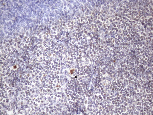 ZC3H8 Antibody - Immunohistochemical staining of paraffin-embedded Human tonsil within the normal limits using anti-ZC3H8 mouse monoclonal antibody. (Heat-induced epitope retrieval by 1mM EDTA in 10mM Tris buffer. (pH8.5) at 120 oC for 3 min. (1:150)