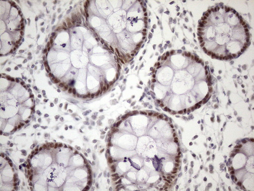 ZC3H8 Antibody - Immunohistochemical staining of paraffin-embedded Human colon tissue within the normal limits using anti-ZC3H8 mouse monoclonal antibody. (Heat-induced epitope retrieval by 1mM EDTA in 10mM Tris buffer. (pH8.5) at 120 oC for 3 min. (1:150)