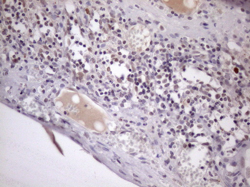 ZC3H8 Antibody - Immunohistochemical staining of paraffin-embedded Human bladder tissue within the normal limits using anti-ZC3H8 mouse monoclonal antibody. (Heat-induced epitope retrieval by 1mM EDTA in 10mM Tris buffer. (pH8.5) at 120 oC for 3 min. (1:150)