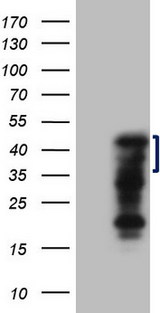 ZC3H8 Antibody - HEK293T cells were transfected with the pCMV6-ENTRY control. (Left lane) or pCMV6-ENTRY ZC3H8. (Right lane) cDNA for 48 hrs and lysed. Equivalent amounts of cell lysates. (5 ug per lane) were separated by SDS-PAGE and immunoblotted with anti-ZC3H8. (1:2000)